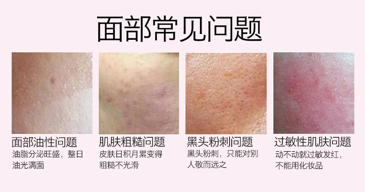 硅胶洗脸刷,硅胶章鱼洗脸刷,硅胶洁面刷,硅胶洗脸神器 硅胶洗脸刷,硅胶章鱼洗脸刷,硅胶洁面刷,硅胶洗脸神器